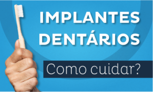Implantes Dentários: Como cuidar?